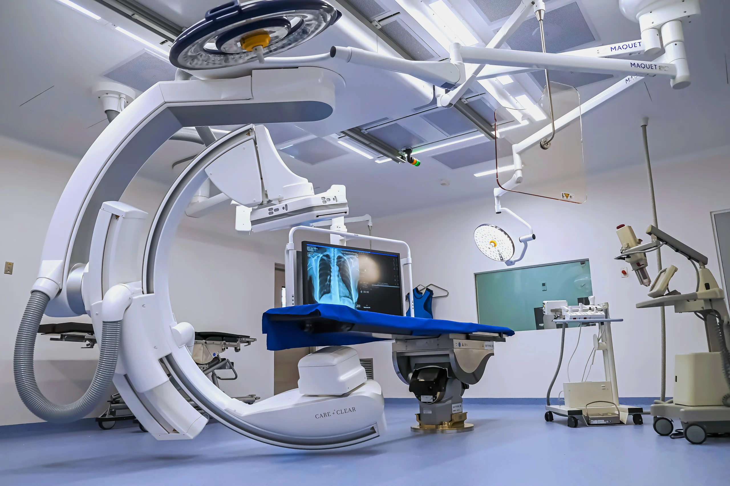 Vista interior de una moderna sala de cirugía híbrida equipada con un sistema de arco en C y tecnología médica avanzada